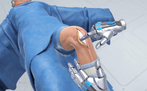 Ghost Productions: Wraith VR Total Knee Replacement Surgery Simulation Torrent Download